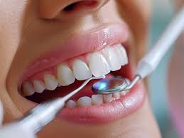 لمینیت دندان در کرج