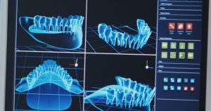 ایمپلنت دیجیتال در کرج