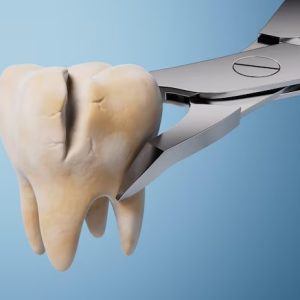 ترمیم دندان شکسته